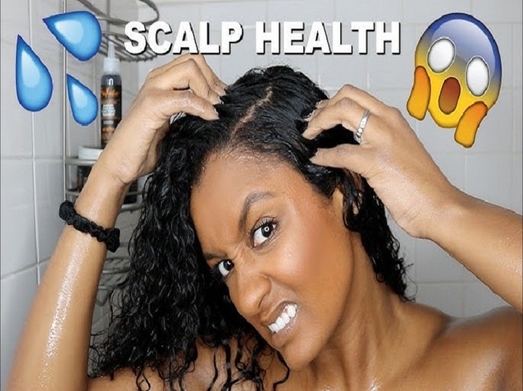 Healthy Scalp