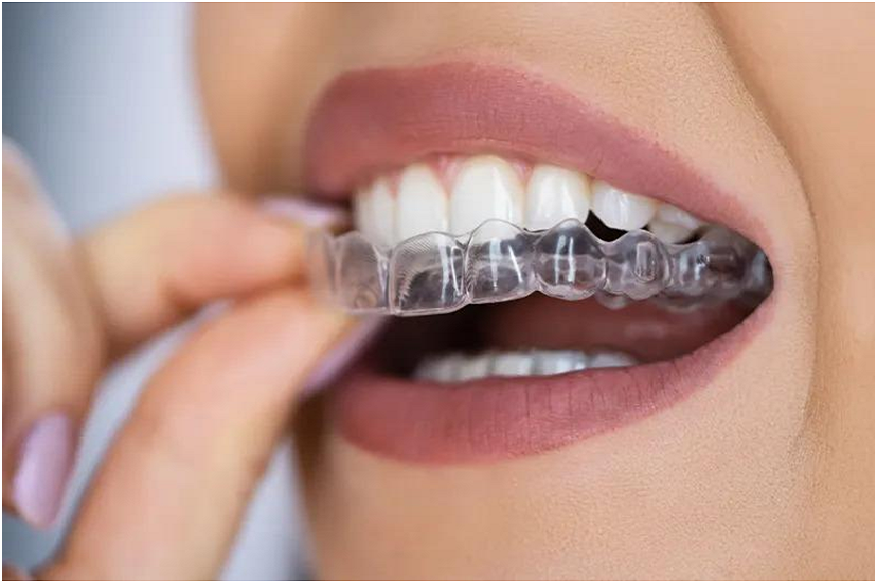 Invisalign Freeport